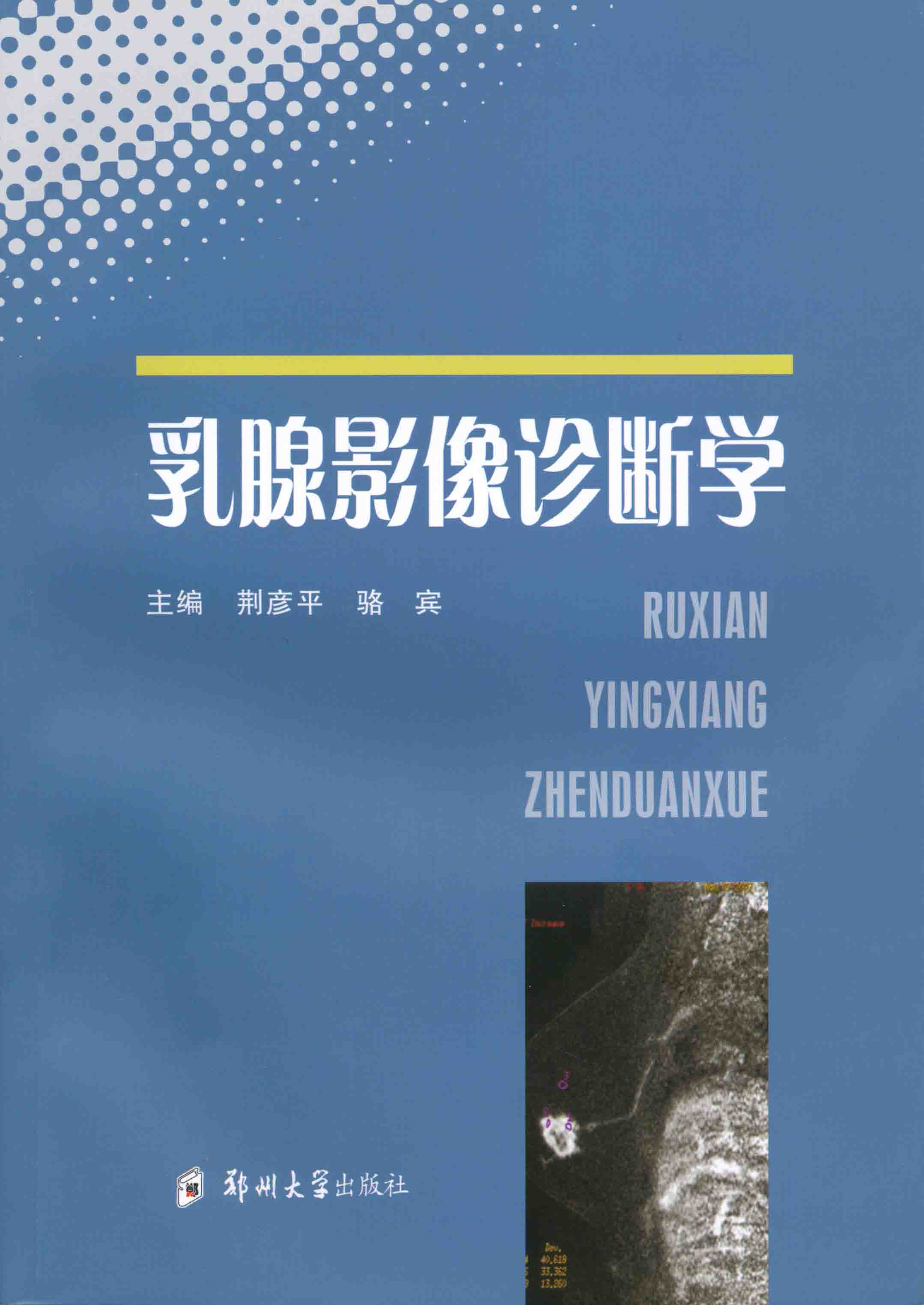 乳腺影像診斷學